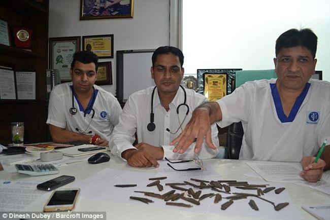 Dokter menunjukkan pisau-pisau yang ditemukan di perut pasien | Photo: Copyright asiantown.net