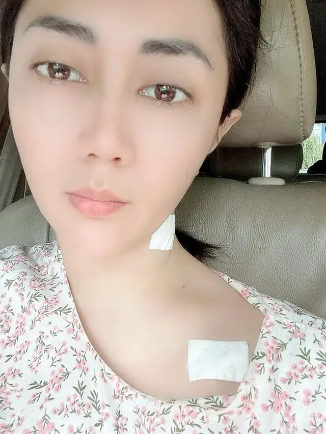 Sempat Prank Bunuh Diri, Ini 7 Potret Terbaru Aida Saskia Berjuang Lawan Kanker