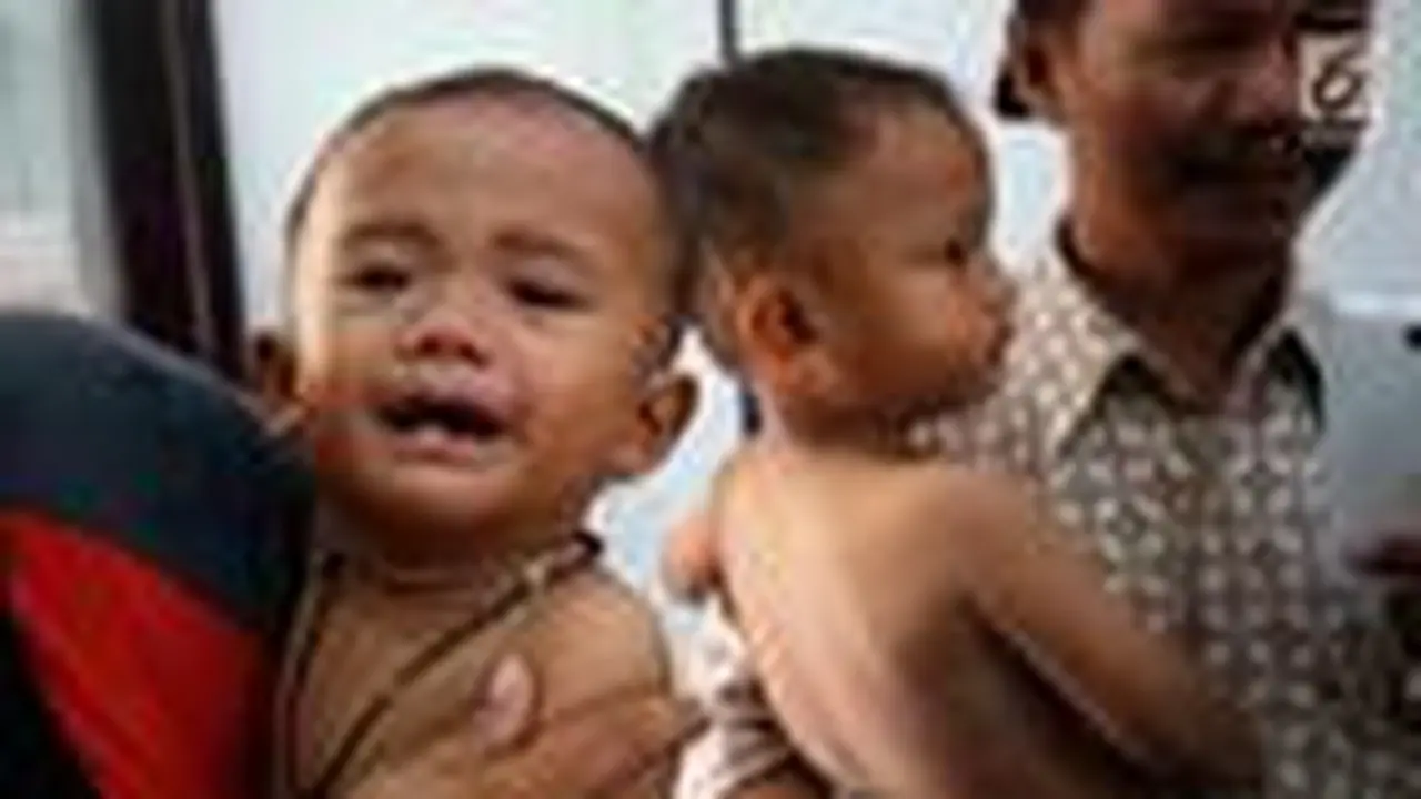 Nampak beberapa anak kekurangan gizi yang terjadi di daerah Pandeglang