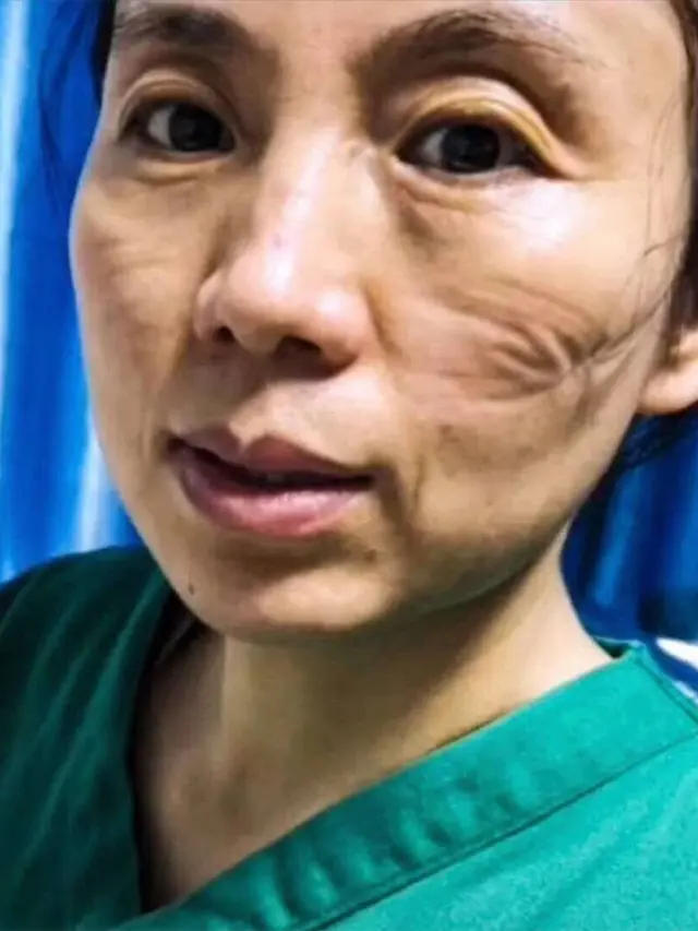 6 Potret Wajah Suster Rawat Pasien Virus Corona Ini Bikin Haru