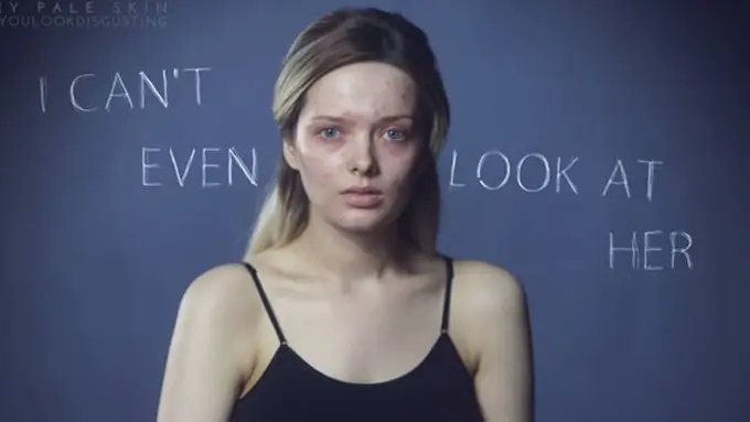 Foto: copyright Youtube.com/My Pale Skin