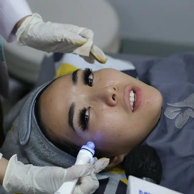 [Fimela] Gisella Anastasia