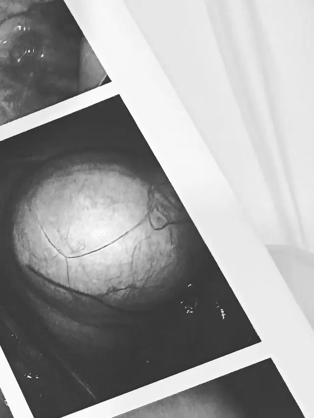 Shireen Sungkar dan Teuku Wisnu