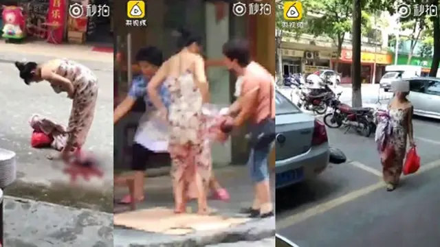 Gambar video wanita melahirkan di sebuah jalanan di China. (Pear Video)