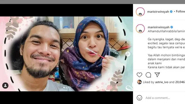 Mario Irwinsyah (Foto: Instagram/@marioirwinsyah)