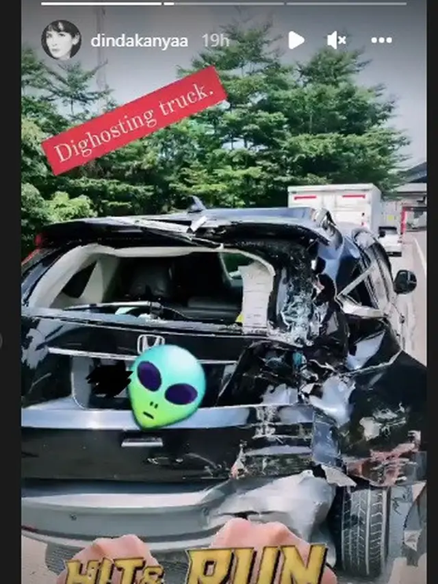 Dinda Kanya Dewi umumkan alami kecelakaan (Foto: Instagram @dindakanyaa)