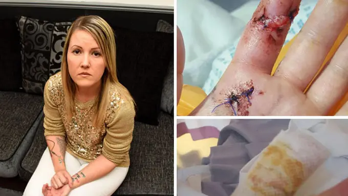 Berpesta, Jari Perempuan Ini Hampir Putus