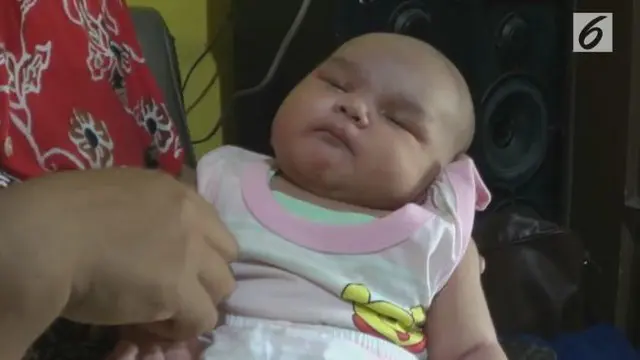 Seorang bayi laki-laki pasangan Yuni dan Abdul Muid di Sidoarjo, Jawa Timur terlahir dengan berat badan 6,4 kilogram.
Giorby Dwi Rayasa bayi diatas rata-rata sempat dirawat enam belas hari di rumah sakit. (sab)