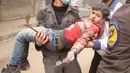 Ekspresi seorang anak yang diselamatkan usai terjadi serangan udara dari pasukan Assad di wilayah Ghouta timur, Suriah (7/2). Dalam serangan ini dilaporkan sedikitnya, 47 warga sipil tewas. (AFP Photo/Hamza Al-Ajweh)
