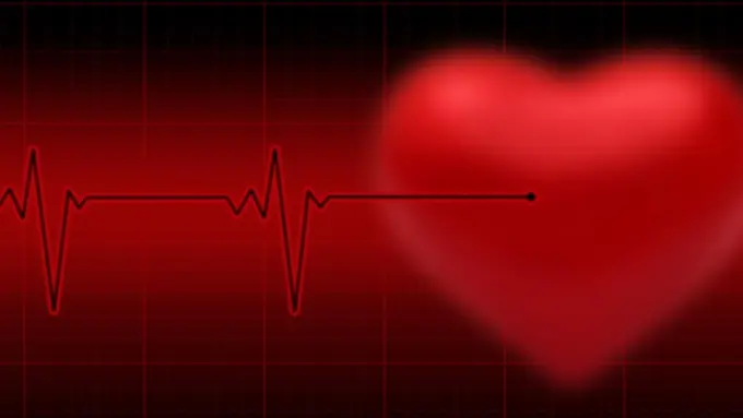 Apa itu Henti Jantung Mendadak?