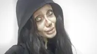 Remaja Ini Lakukan 50 Operasi Plastik demi Mirip Angelina Jolie