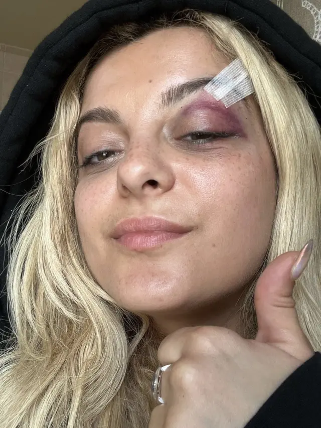Bebe Rexha Luka