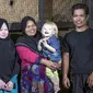 Dari kiri: Dewi Resmana,13, Siti Rohmah, 33, Jajang Gunawan 2,5; Ujang Nana Suryana, 33, salah satu keluarga keturunan Albino di Desa Ciburuy, Jawa Barat. (Salman Toyibi/Jawa Pos)