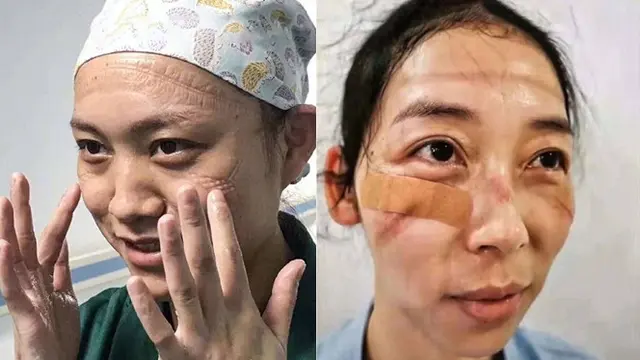 4 Kisah Perjuangan Dokter dan Perawat di Wuhan Rawat Pasien Virus Corona, Bikin Haru