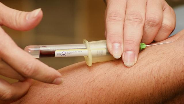 Dapat Membantu Menurunkan Kadar Kolesterol Pada Tubuh