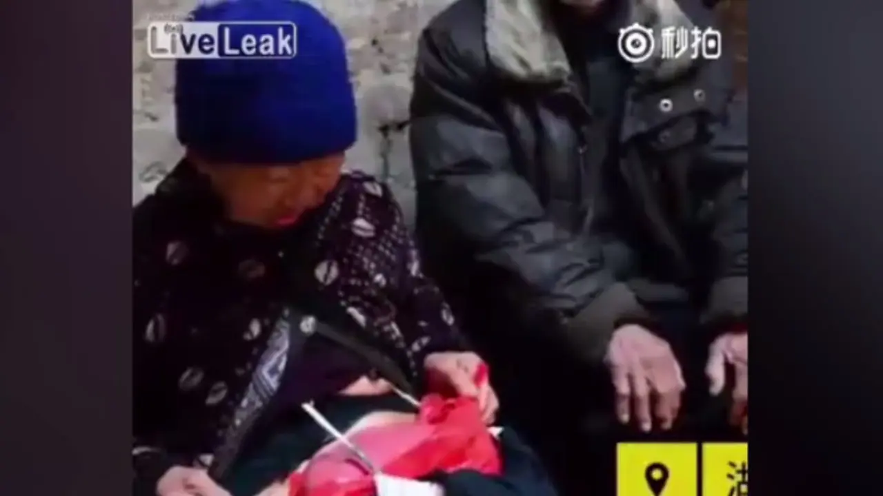 Tak Punya Biaya, Wanita Tua Bawa Ususnya dalam Plastik Kemanapun