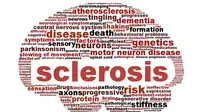Multiple Sclerosis, Si Penyakit Seribu Wajah