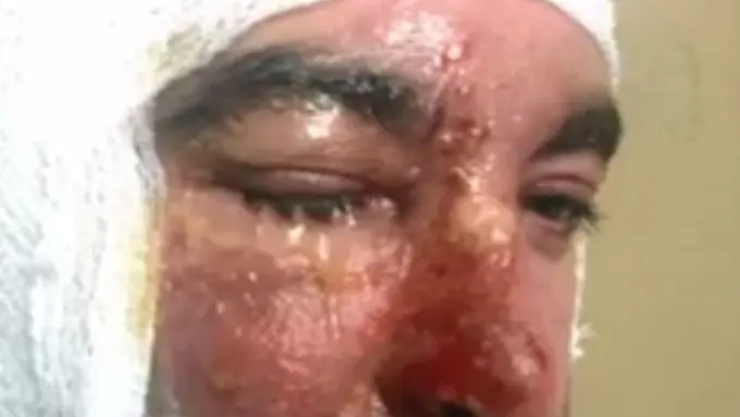 Hati-hati, Ini yang Terjadi Kalau Blender di Rumahmu Meledak!