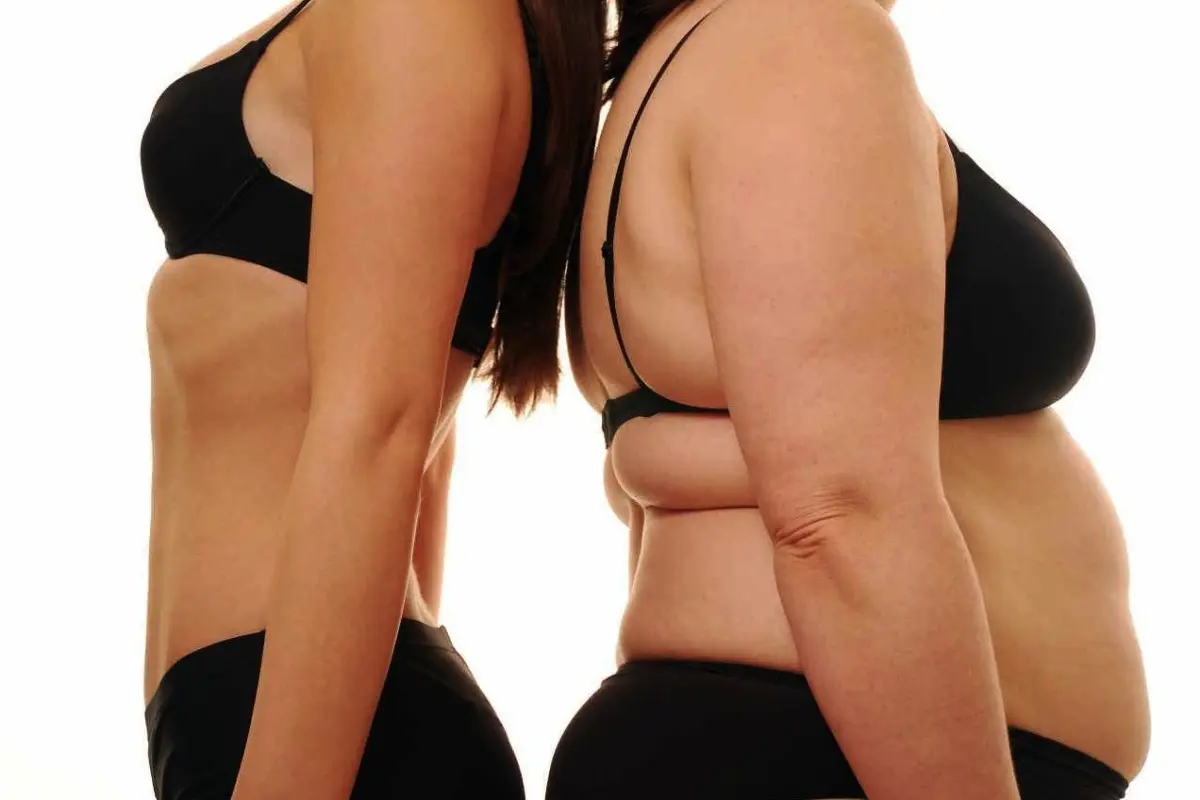 Kini, Lebih Banyak Orang Obesitas dibanding Kurus