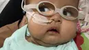 Anak kedua yang telah dinanti selama delapan tahun itu kini memakai kaca mata. Kacamata yang dipakai itu berbeda dengan kacamata dewasa, guna membantu retinanya berkembang baik setelah operasi. (Instagram/asri_welas)