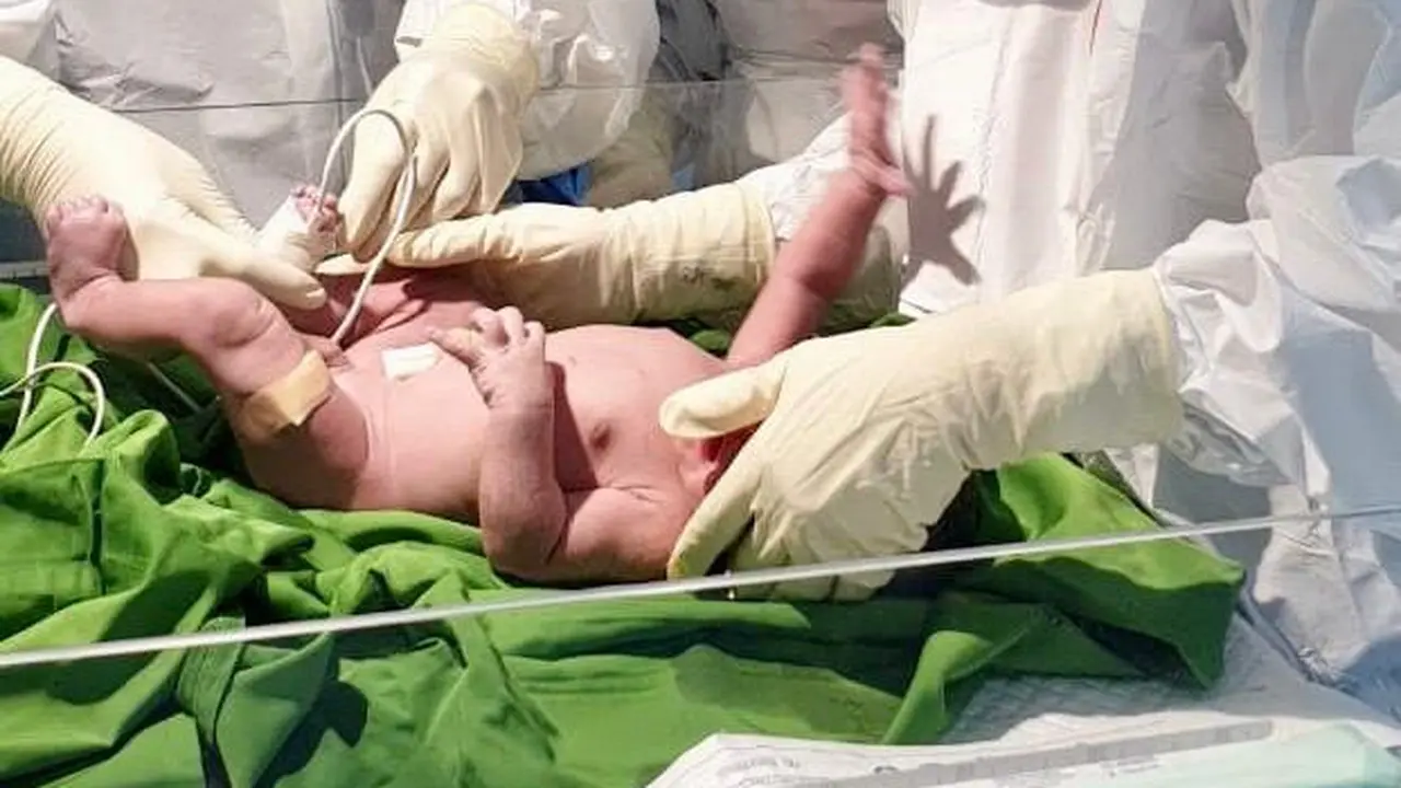 Seorang pasien positif Covid-19, berinisial EF melahirkan bayi laki-laki sehat di Rumah Sakit Siloam Kelapa Dua, Kabupaten Tangerang.