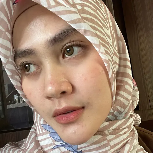 Henny Rahman Hamil dan Akui Wajahnya Berubah, Ini 6 Potret Terbarunya