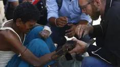 Pendiri Disaster Hack, Matthew Rockwell memasang tangan palsu buatan 3D ke lengan penderita kusta, Ram di Kathmandu (14/7). Tangan palsu yang dibuat dari mesin cetak 3 Dimensi (3D) jauh lebih murah dibandingkan tangan palsu Prostetis.(AFP Photo/Gopen Rai)