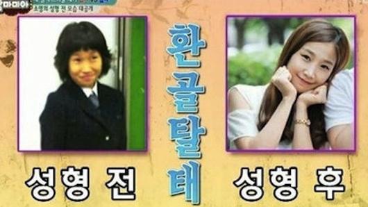 Foto Park sebelum dan sesudah bedah plastik | Foto: rocketnews24.com