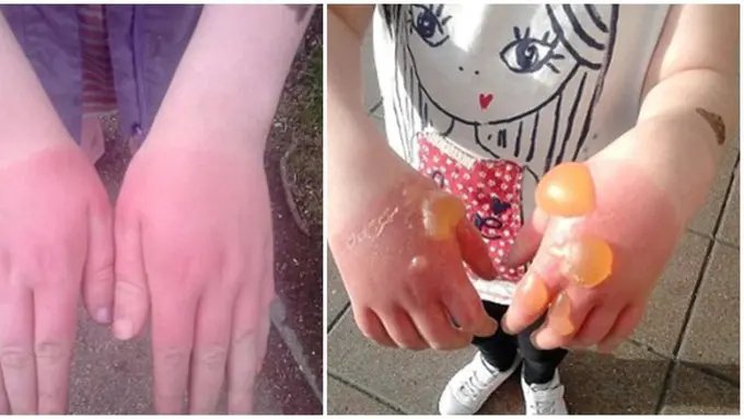 Foto: copyright dailymail.co.uk