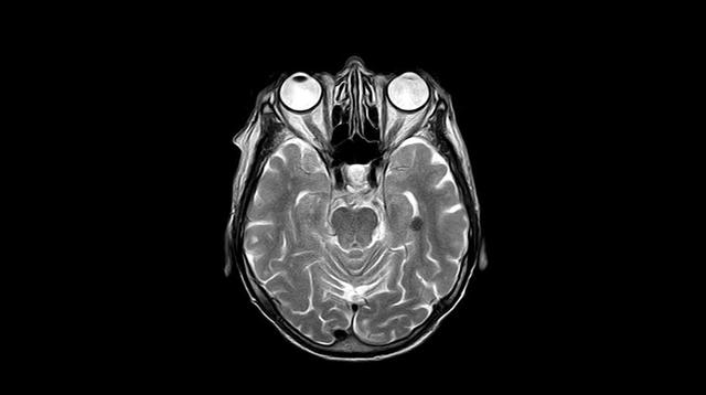 Ilustrasi Sinar X, X Ray, Radiologi. Kredit toubibe via Pixabay