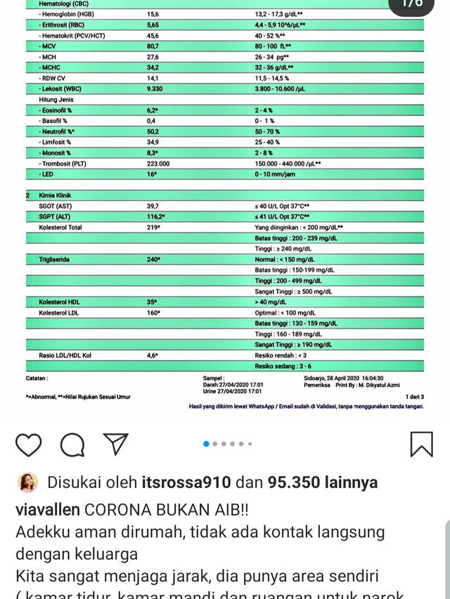 Unggahan Via Vallen. (Foto: Instagram @viavallen)