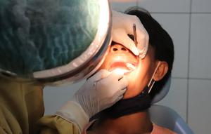 Ilustrasi Gigi Berlubang/https://unsplash.com/Mufid Majnun