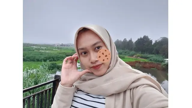 Wanita Ini Minta Jerawat Dihilangkan, 6 Hasil Editan Foto Bikin Senyum