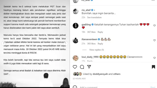 Rio Alief ceritakan perjuangan Clerence melawan kanker (Foto: Instagram rio_alief)