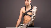 James Young dan lengan robotik besutan Konami dan Open Bionics (sumber: digitaltrends.com)
