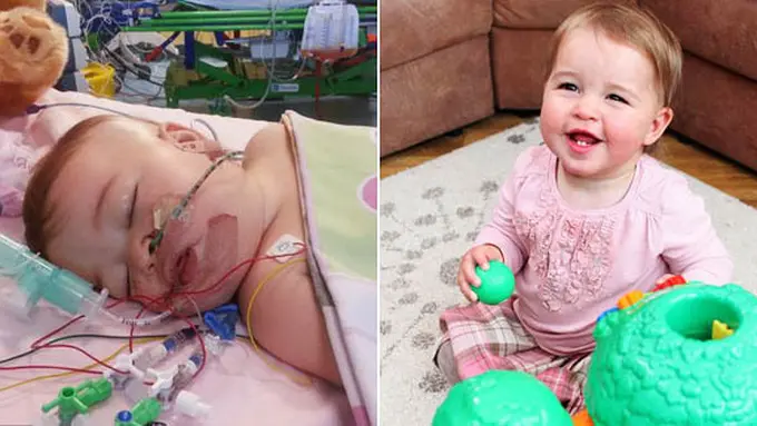 Foto Willow saat dirawat dan sehat | Courtesy: Dailymail.co.uk