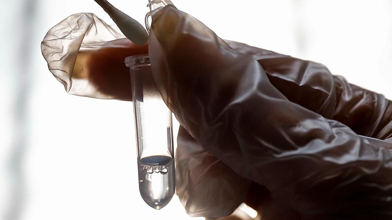 Intip Penanganan Pasien Virus Corona di Iran