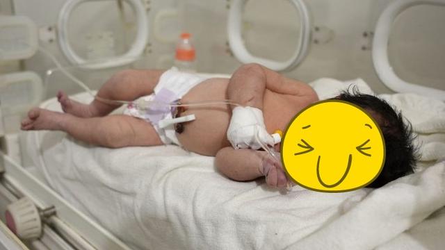 Bayi Lahir di Bawah Reruntuhan Bangunan, Tali Pusar Masih Melekat dengan Ibunya yang Tia