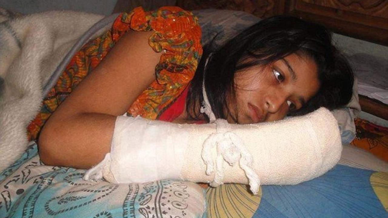 Istri Ingin Sekolah Lagi, Suami Malah Potong Jarinya