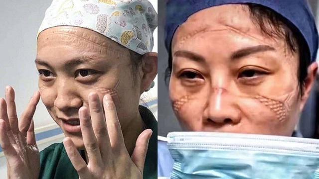 4 Perjuangan Dokter Dan Perawat Di Wuhan Rawat Pasien Virus Corona