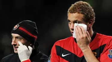 Bek Manchester United, Wes Brown (R) menerima perawatan menyusul cedera di pipinya di laga lawan Tottenham Hotspur yang berlangsung di Old Trafford, 1 Desember 2009. AFP PHOTO / PAUL ELLIS 