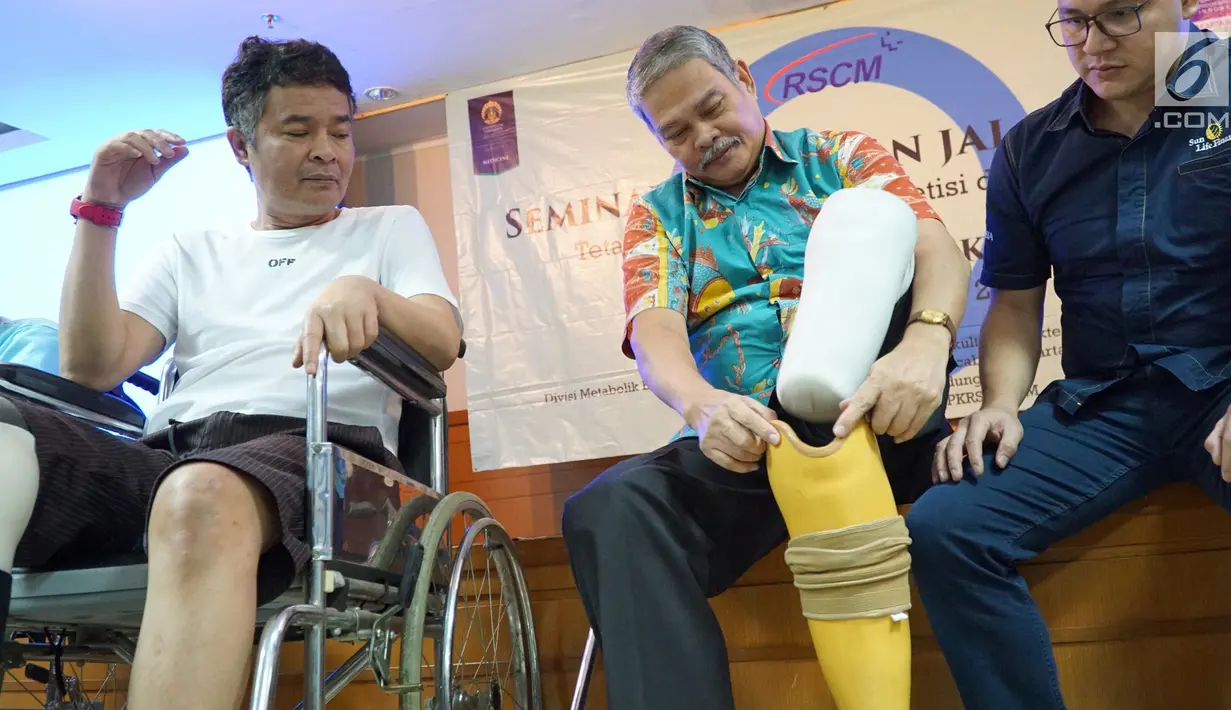 Pasien sedang memasang alat bantu jalan berupa kaki prostetik dan sepatu diabetes dalam rangka memperingati Hari Diabetes Sedunia di RSCM, Jakarta, Rabu (14/11). (Liputan6.com/HO/Megha)
