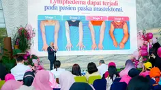 Limfedema Bisa Muncul Usai Operasi Kanker Payudara
