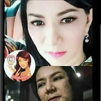Inilah wajah Rita Widyasari yang tengah jadi perbincangan masyarakat dunia maya. Dulu mulus, sekarang… (Instagram)