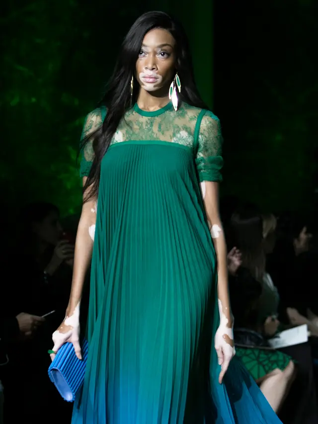 Winnie Harlow di Panggung Paris Fashion Week