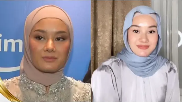 Potret Wajah 6 Artis Ini Jadi 'Korban' Kamera Wartawan, Perbedaannya Disorot