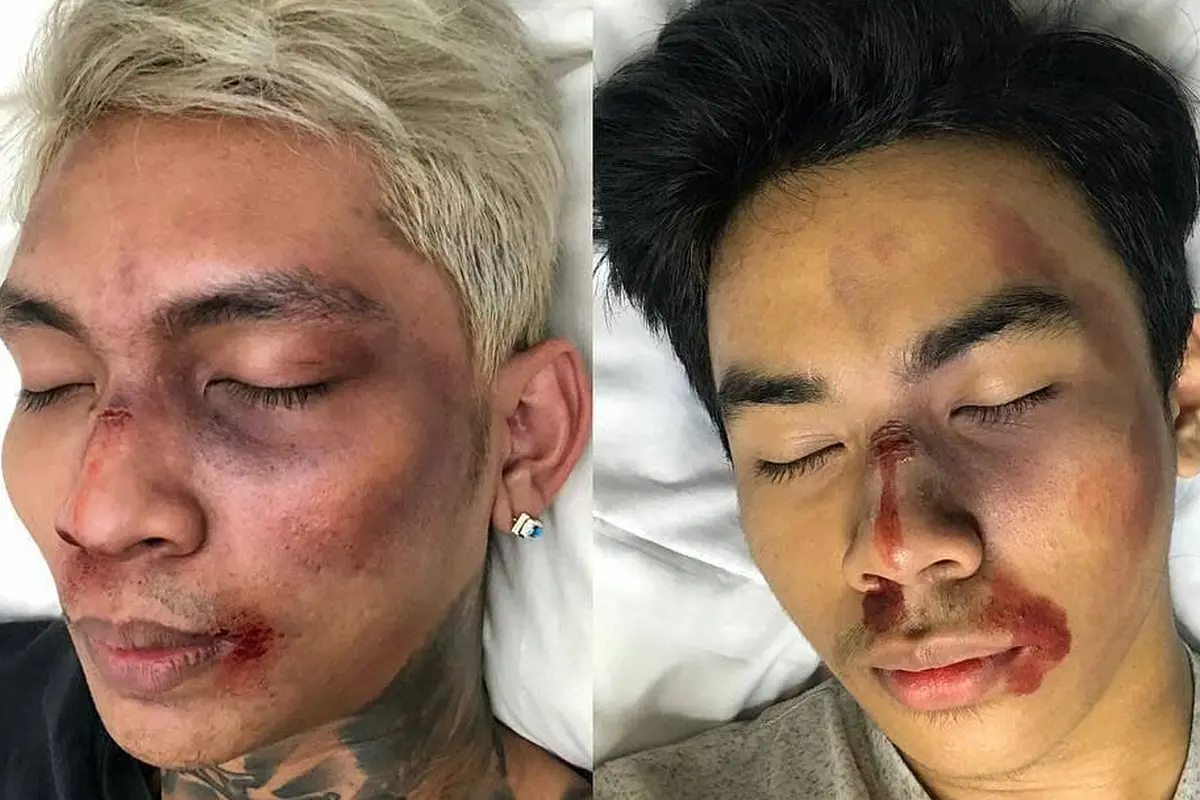 [Bintang] Young Lex