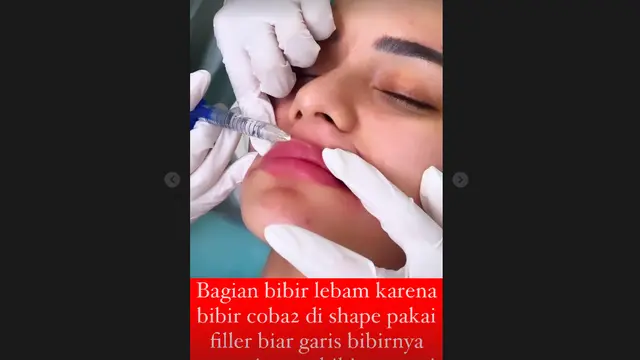 Nora Alexandra Bantah Wajahnya Lebam Karena Dipukul, Beber Fakta Sesungguhnya. (instagram.com/ncdpapl)