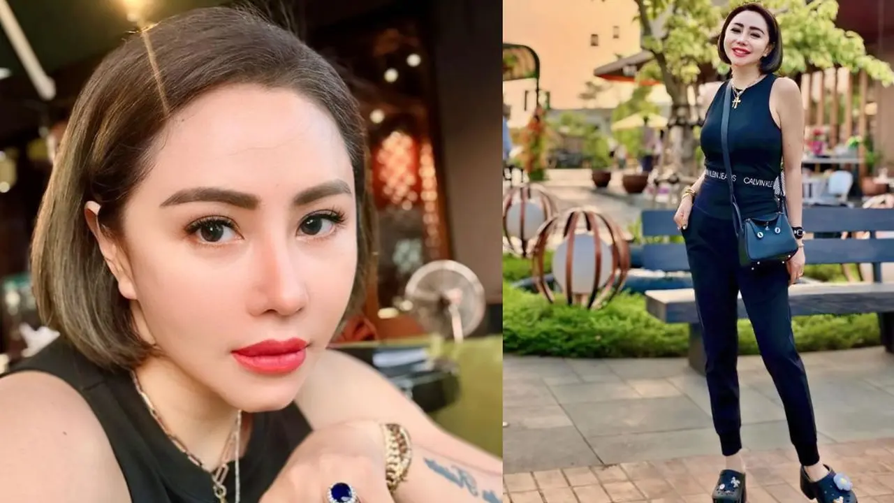 Kisah Mengharukan Femmy Permatasari yang Pernah Koma Hingga Amnesia dan Tidak Mengenali Orang