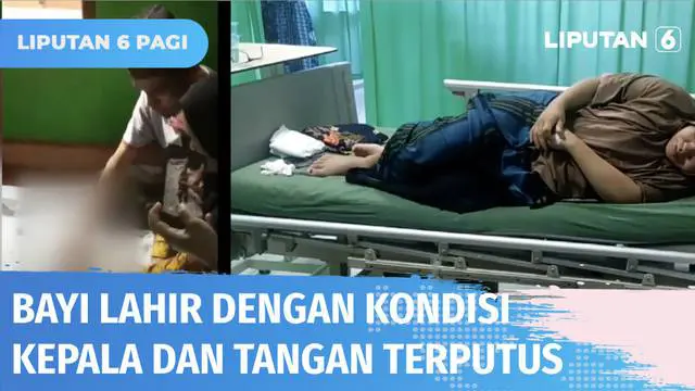 Bayi pasutri ini lahir dalam kondisi yang mengenaskan, kepala dan tangannya terputus. Pihak RSUD Bulukumba dalam konferensi persnya mengklaim proses persalinan sudah sesuai SOP.